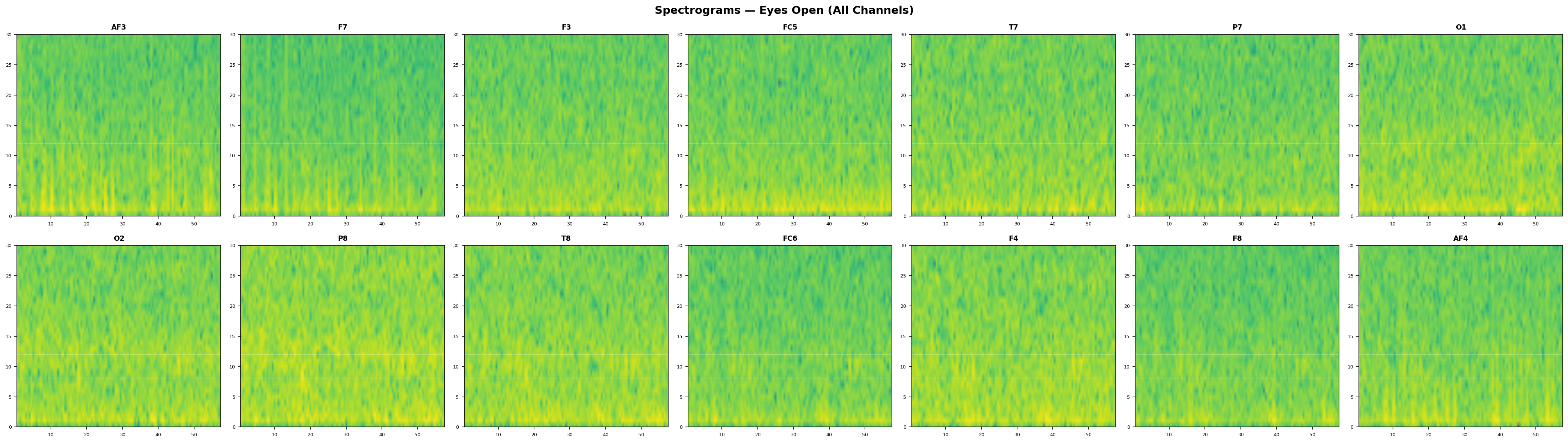 Spectrograms Eyes Open